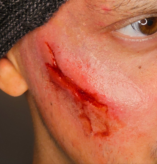 Gash 02 Prosthetic Transfer